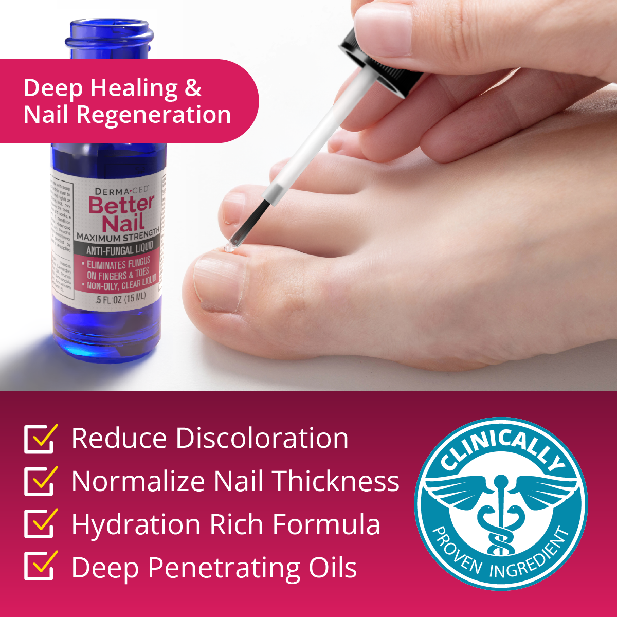 Better Nail - Treatment for Fungus Under & Around the Nail